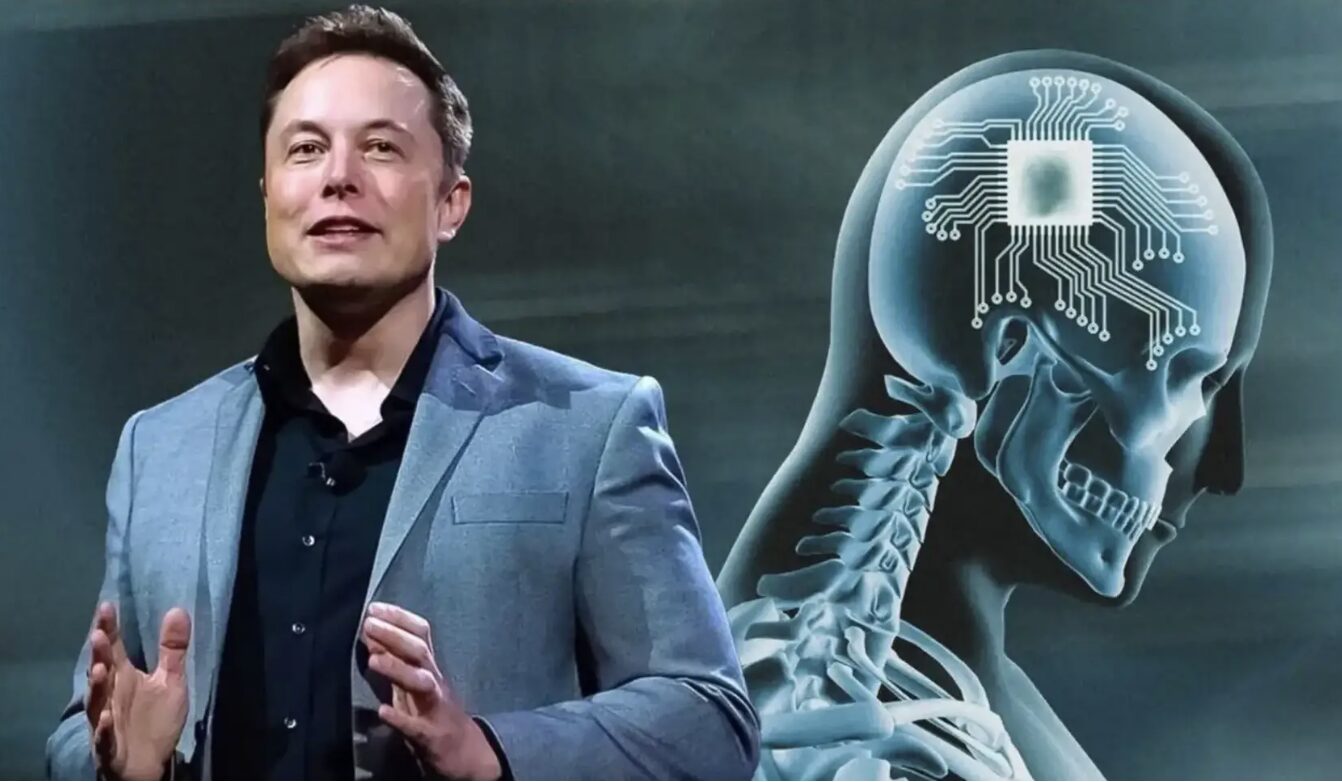 Neuralink của Elon Musk