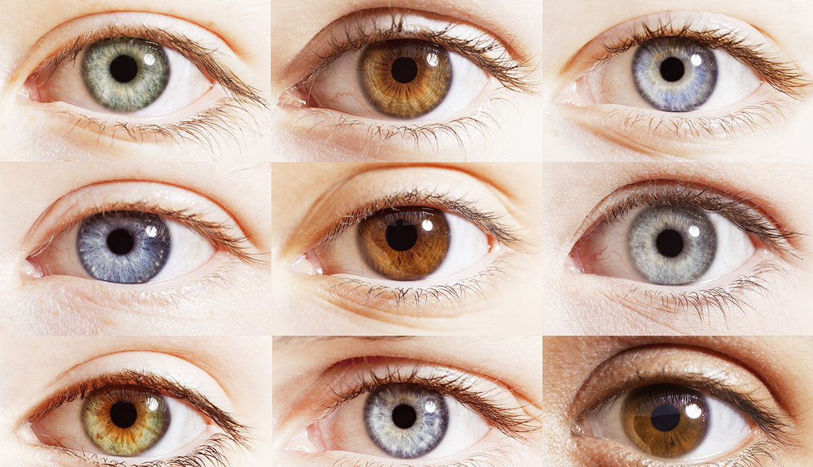 keratopigmentation